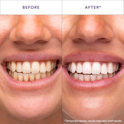 Hismile V34 Whitening Strips, Teeth Whitening Strips, Purple Whitening Strips, Whitens After One Use* - 28 Applications (46 Individual Strips) (Pack of 2) 1 Count (Pack of 28)