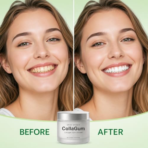 Collagen Tooth Powder, Collagen Gum Powder with Hydroxyapatite & Natural Vitamins for Daily Gumline Care, Peppermint Oral Care Powder for Brushing Routine, 1.76oz