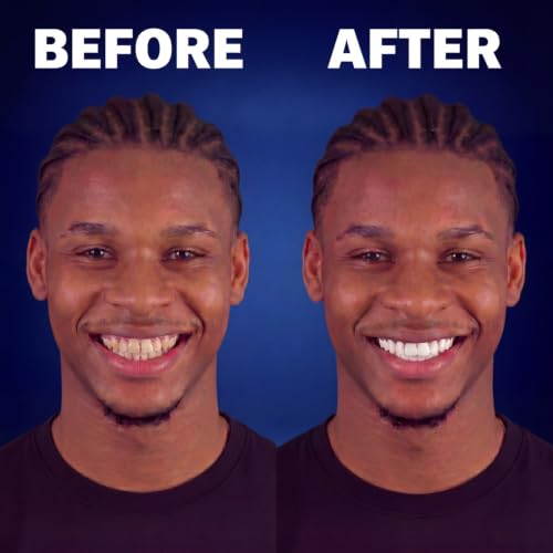 Teeth Whitening Strips for Men – Professional At-Home Whitening Kit, 14 Treatments (28 Strips) | Enamel-Safe 7% Hydrogen Peroxide, No Sensitivity | Visible Results in Days Mint Fresh