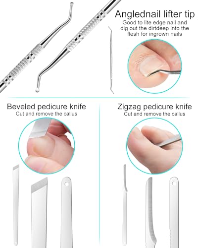 7pc Ingrown Toenail Remover Pedicure Tools Kit, Nail Clippers, File and Lifters Set for In Grown nails Removal, Professional Surgical Stainless Ingrown Toenail Tool Under Nail Cleaner