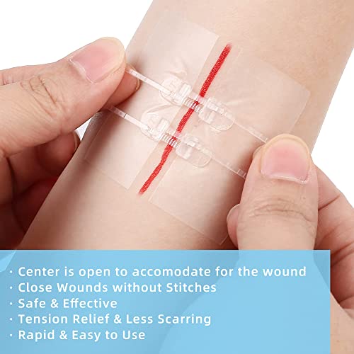 10PCS Transparent Film Dressing 6x8 inch and Emergency Wound Closures Kit Bundles