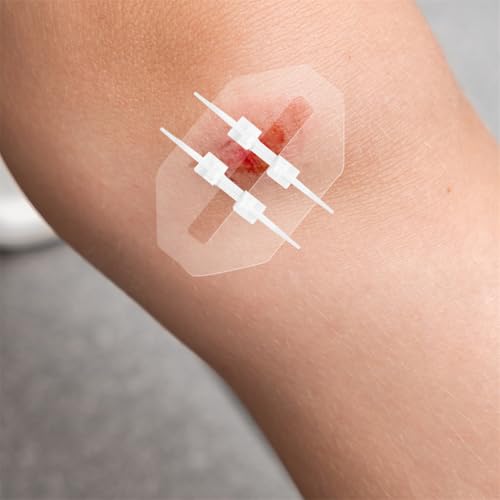 Emergency Wound Closure Strip 2PCS Wound Closure Kit Zip Stitch Wound Closure Device Laceration Closure Kit Wound Closure Glue Bandages Sutures to Close the Cut 6X7CM