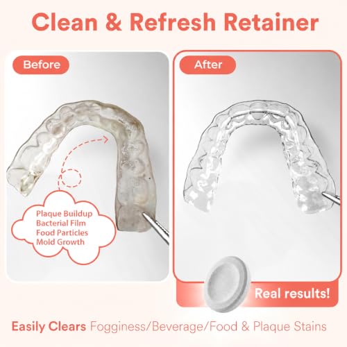 Weiss Naturals Dye-Free Retainer Cleaning Tablets, Invisalign Cleaner, Persulfate-Free Night Guard Cleaner, Removes Stains & Odor, MINT Scent, 120 Tablets (4-Month Supply) 120 Count (Pack of 1)