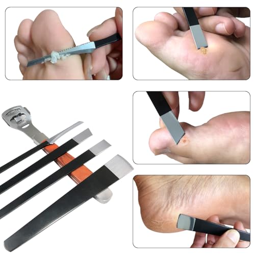 36 Pcs Callus Shaver for Feet Set, Foot Callus Shaver, (1 Stainless Foot File &1 Foot File Heads & 4 Pedicure Knife & 30 Replacement Slices Blades) B-set