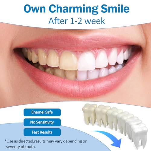 KTSAY Teeth Whitening Pen - Professionally Stain Removal Teeth Whitening Gel Formula, No Sensitivity Effective Teeth Whitener, Mint (0.11 Fl Oz (Pack of 4))