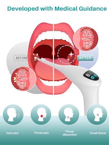 Voraiya Electronic Tonsil Stone Remover Upgraded Version, Tonsil Camera and LED Light, 5-Level Suction Tonsil Stone Vacuum,Tonsil Stone Removal Kit, APP Control