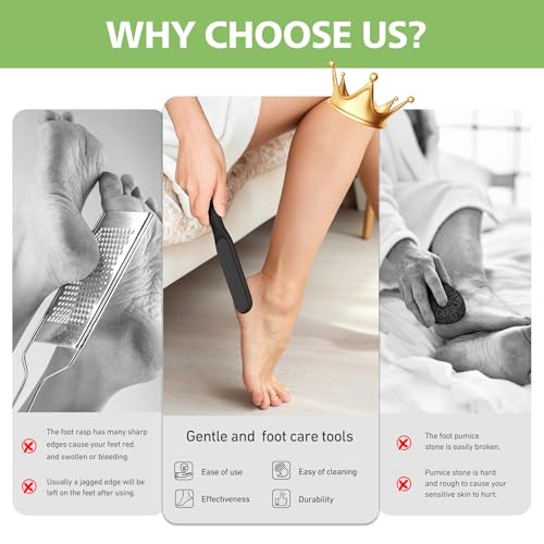 BALUCA Glass Foot File Callus Remover for Feet, Heel Scraper Black