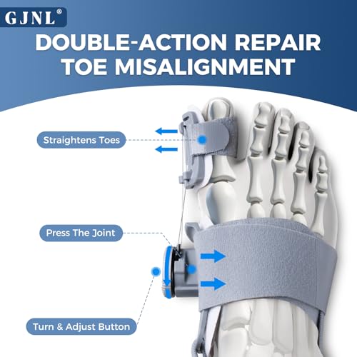 GJNL Bunion Corrector for Women & Men – Upgraded Adjustable Bunion Fix for Big Toe Separation Pain Relief, Bunion Splint Suitable for Left/Right Feet, Toes Alignment Hallux Valgus Correction (Grey) Grey