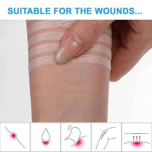 Skin Wound Closure Suture Strips 50 Sterile Quick Stitches Tape for Superficial Cuts and Incisions 6*100mm