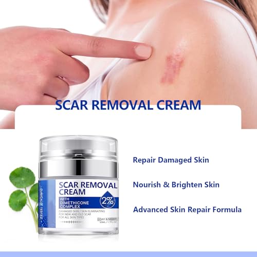 Scar Cream, Scar Removal Cream - Advanced Scar Cream for Surgical Scars, Acne Scars, C-Section, Burns, Stretch Marks -Effective for Old and New Scars Gel Acne Scar Treatment