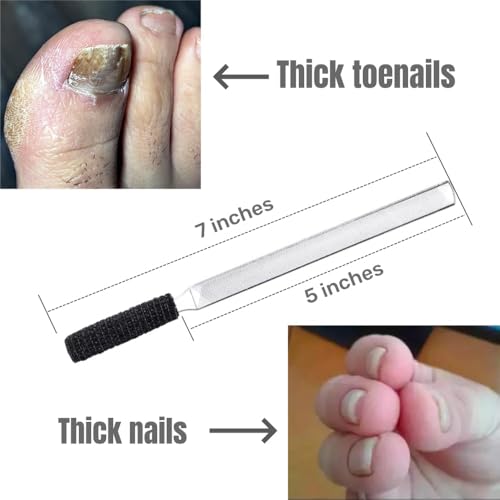 7" Toe Nail Files for Thick Nails, Heavy Duty Metal Nail File - SJ7 Large 0.8