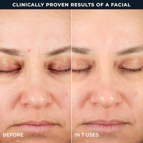 RoC Retinol Correxion Line Smoothing 2-Step Peel Pads - 20 Treatments 20 Count (Pack of 1)