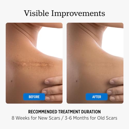 NUVADERMIS Scar Cream Gel for Surgical Scars | Retinol & Vitamin E, 1.7oz 1 Pack
