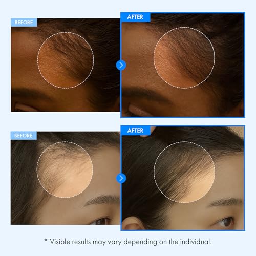 TOSOWOONG Real Relief Rolling Serum for Scalp Care & Soothing, Cooling