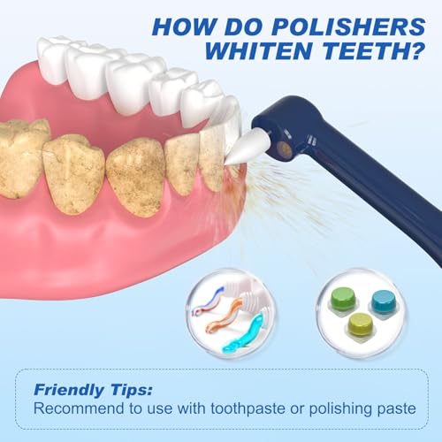 Tooth Polisher, Tooth Whitening Kit for Teeth Cleaning and Whitening, Rechargeable Teeth Polisher for People/Pets,Teeth Cleaning Kit with 5 Brush Heads,4 Speed Modes and LED Light, Waterproof(Blue) Blue