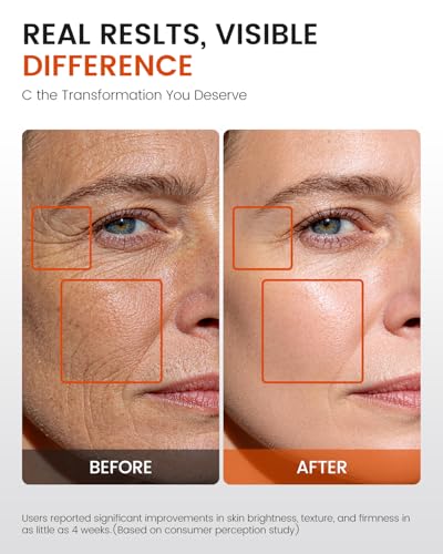 Super C Serum for Mature Skin – All-in-One Vitamin C Serum for Face with Retinol & Hyaluronic Acid for Women Over 60 & 70 – Anti-Aging Hydrating Serum for Wrinkles & Fine Lines 1.0 fl.oz. 1 Fl Oz (Pack of 1)