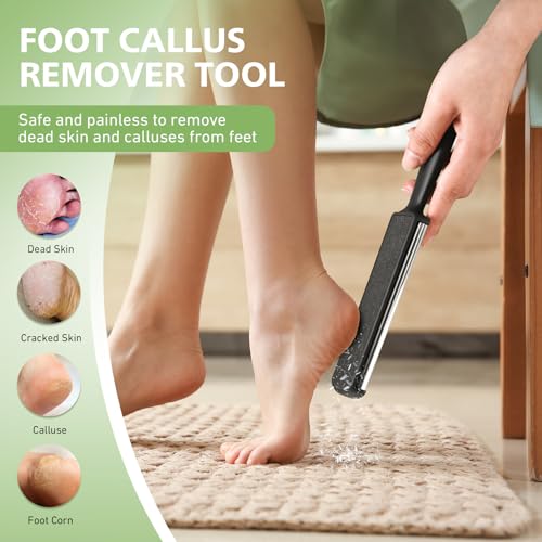 BALUCA Foot Files Callus Remover Stainless Steel Foot Rasp and Dual Sided Feet File Professional Scrubber Pedicure Tools Premium for Feet Care Remove Hard Skin, Black