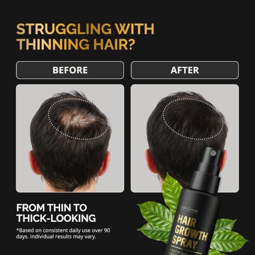 Hair Growth Serum Spray for Women & Men Hair Loss – Biotin & Caffeine, Anti-Thinning Hair Regrowth Oil, Advanced Thickening Formula – 1.7 fl. oz./ 50 ml 1.7 Count (Pack of 1)
