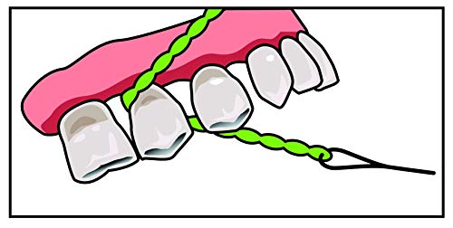 IDontix Brace X-Floss, Green