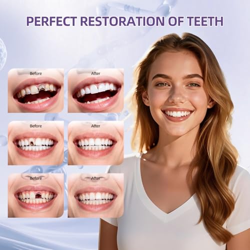 Tooth Repair Kit, Zinc Oxide Eugenol Cement for Cavities Filling, Dental Care Kit for Broken, Chipped or Missing Teeth, Temporary and Permanent Tooth Filling and Crown Fixing at Home