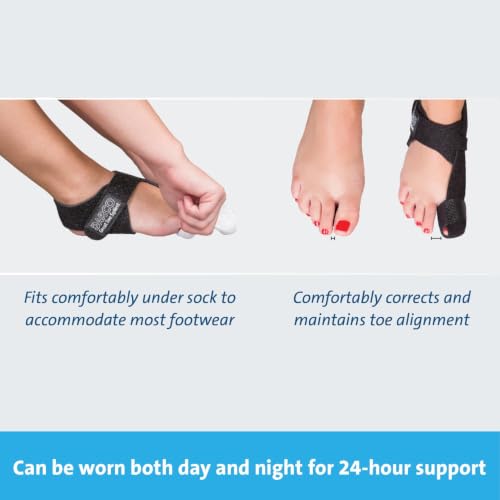 DARCO GTS Black Great Toe Alignment/Bunion Adjustable Splint for Hallux Valgus and Other Joint Conditions (SM/Left W5-7.5/M7-9.5) SM/LEFT W5-7.5/M3.5-6