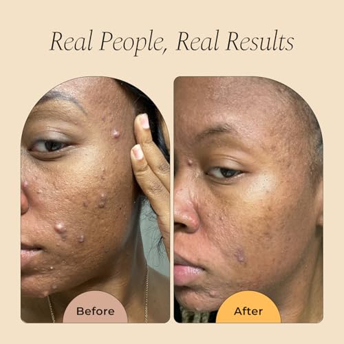 Glo Melanin Turmeric & Kojic Foaming Face Wash - 120ml