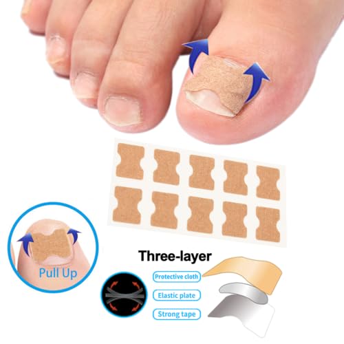 Professional Ingrown Toenail Correction Kit, Pedicure Care Tools