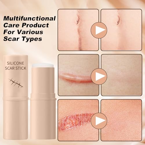 2pcs Scar Solutions Silicone Scar Stick, Made of 60% Silicone, Lightweight & Easy to Apply, Gentle on All Skin Types