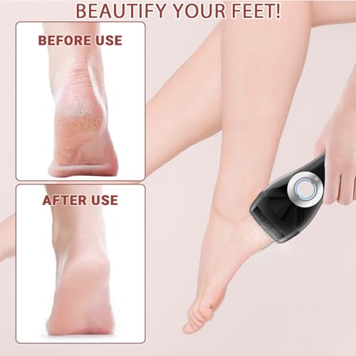 Upgraded Rechargeable Foot Callus Remover, Professional Electric Foot File, 18 in 1 Pedicure Tools Foot Care Kit Pedi Feet Care for Dead, Hard Cracked Dry Skin Ideal Gift (Black) Black