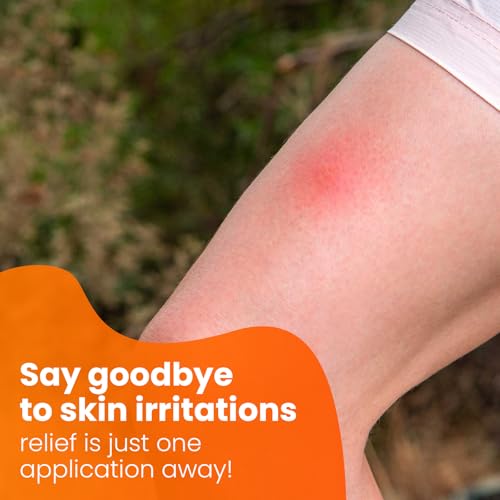 AVEDANA Hydrocortisone Ointment 1% USP Maximum Strength - 1oz Anti Itch Ointment for Fast Relief - Soothing and Calming Waterproof Formula with Aloe Vera