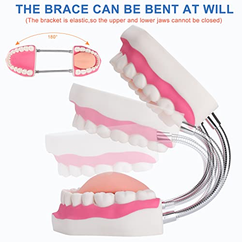 Tooth Brushing Model - 6 Time Tongue Teeth Model Mouth Model for Speech Therapy Kids Dental Care Teaching Demonstration Model