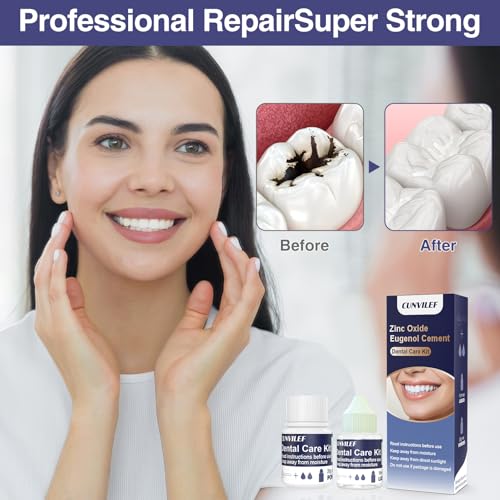 Zinc Oxide Eugenol Dental Cement Tooth Repair Kit for Broken Teeth, Temporary Filling for Crowns, Tooth Filler, Cavity Filler (Natural White) Natural White