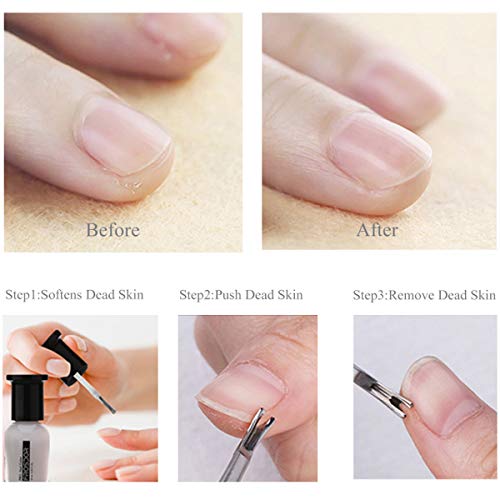 6PCS Cuticle Pusher Set, Stainless Steel Cuticle Remover Kit, Cutter and Trimmer Manicure and Pedicure Tools for Fingernail and Toenails