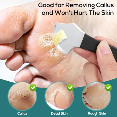 Healifty Pedicure Shaver Foot Corn and Hard Thick Skin Remover Tool Nail File Cuticle Trimmer Heel Scraper for Feet