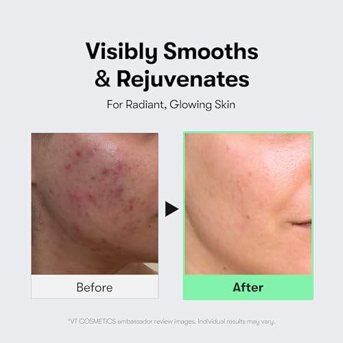 VT COSMETICS CICA Reedle Shot 300, Advanced Night Exosome, Microneedling Serum, Centella Asiatica, Hyaluronic Acid, Propolis, Soft Skin, Regeneration, Glass Skin, Korean Skin Booster 1.69Fl Oz (50ml)