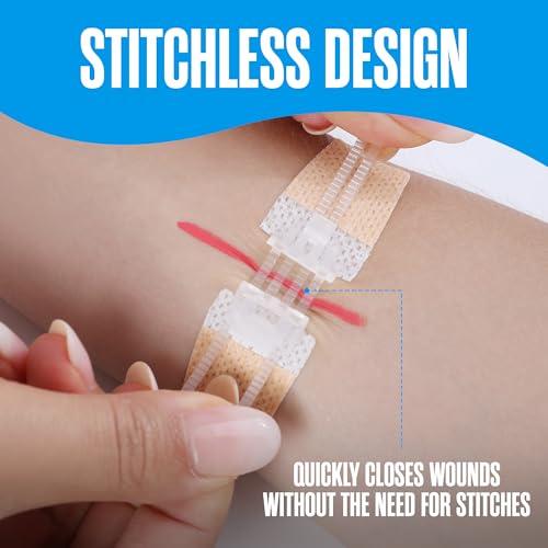 Zip Stitch, Wound Closure Kit, Butterfly Bandages, Zip Tie Bandages 4 Pack