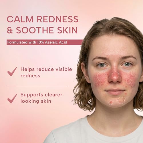 suquato 10% Azelaic Acid Cream – Rosacea Treatment for Face & Redness Reducing Face Cream – Redness & Blemish Care for Sensitive Skin – Lightweight Daily Use 30g 1 Fl Oz (Pack of 1)