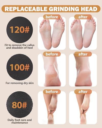 Electric Foot Callus Remover, Callus Remover for Feet with 60 Pcs Sandpaper Discs, Rechargeable & Adjustable Speeds LED Display, 2-in-1 Electric Foot File for Dead Skin Removal & Nail Care