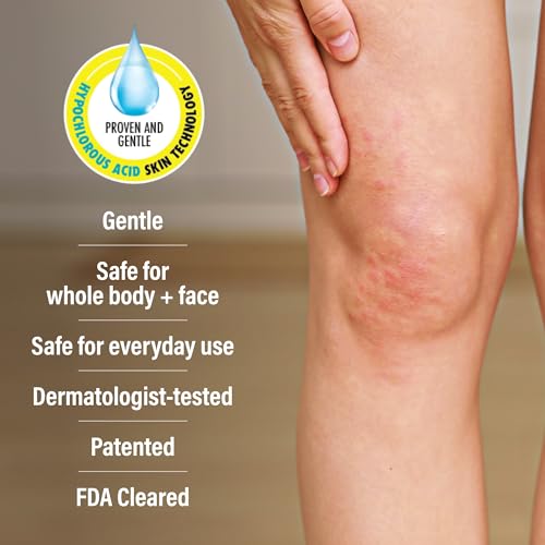 A+D Advanced Dermatitis Hypochlorous Acid Spray, for Face & Body, 4 oz