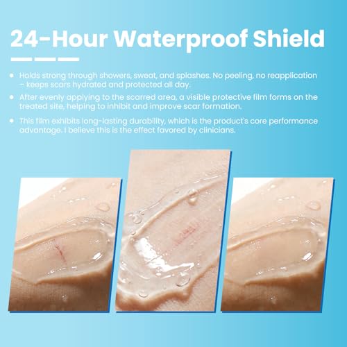 Advanced Scar Gel, Treats New & Old Scars, Reducing the Appearance of Keloid & Bump Scars Caused by Surgery, Acne, Burns, Injury & Stretch Marks-0.53 Oz(15g).
