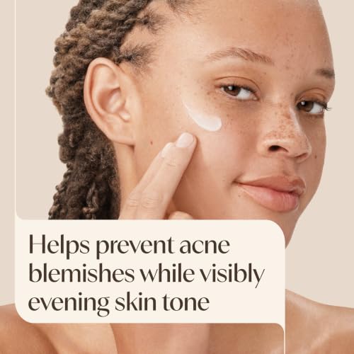 Aveeno Positively Radiant Clear Complexion Acne Face Moisturizer, 4 fl. oz 4 Fl Oz (Pack of 1)
