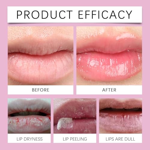 Pink Lip Serum for Dry and Dark Lips, Lip Lightener for Smokers and Non-Smokers, Conditioning LipSerum Moisturizer Help Fade Lips Discoloration with Alpha Arbutin & Aloe Vera 2PCS