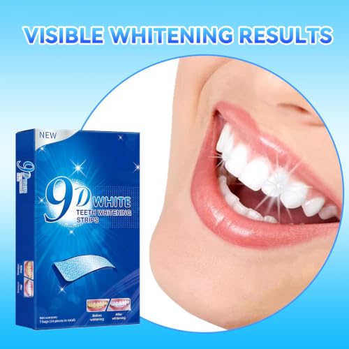 Teeth-Whitening Strips for Sensitive Teeth - Teeth Whitening Kit Professional Effects, Teeth Whitener for Enamel Safe, 14 White Strips (7 Day Treatment) Remove Stains for a Brighter Smile, Mint 14 Count (Pack of 1)