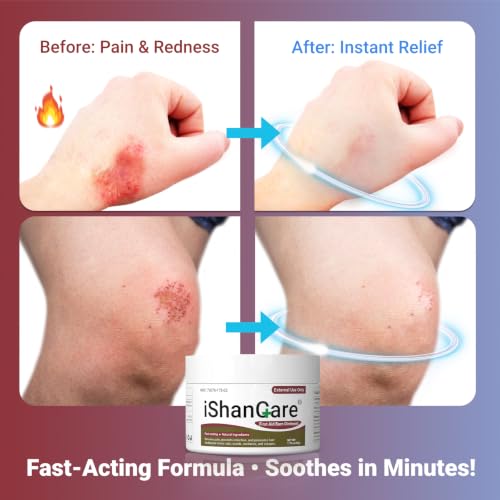 First Aid Burn Ointment with Camellia Oil, Fast-Acting Natural Relief for Burns, Sunburns, Cuts & Scrapes, Ensitive Skin Safe, 1.76oz 1.76 Ounce(50g)