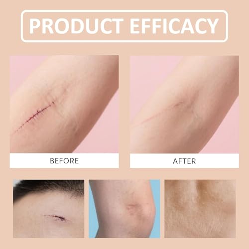 Silicone Scar Stick, Silicone Stick for Face and Body 1Pc