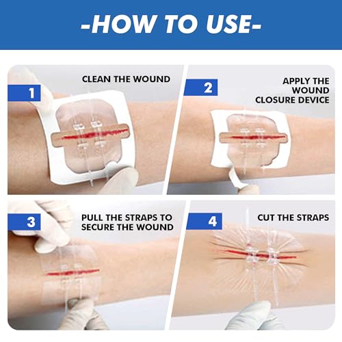 2 Pcs Emergency Laceration Closures,Butterfly Bandaids Wound Closure,Surgical Laceration Repair Without Sew,Quick Clot,Emergency Wound Closures Device (PU) 2 Count (Pack of 1)