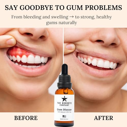 The Goodbye Company Gum Care Bundle – Neem & Clove Gum Treatment + Healthy Gum Rinse | Natural Oral Care for Gingivitis, Bleeding Gums & Fresh Breath | Non-Toxic, BPA-Free