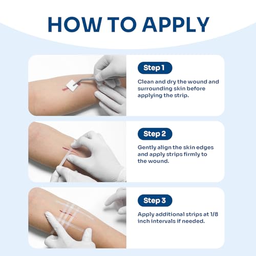 40 Wound Closures, Breathable Strips Hold Small Wounds Firmly Closed