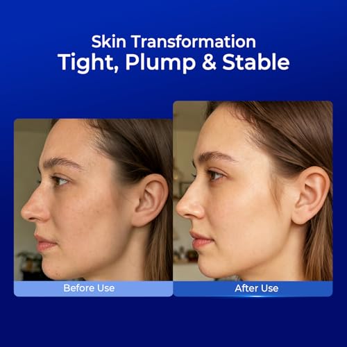 PROFLING Hyaluronic Acid Serum with Copper Peptides, Post-Microneedling Hydrating & Soothing Face Serum for Sensitive, Redness-Prone Skin, Barrier Support, Single-Use Vials 30PCS
