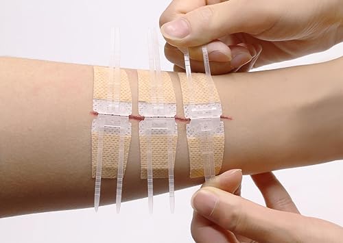 Laceration Wound Closure Device, Emergency Laceration Closure Strips to Repair - Pack of 10 Units